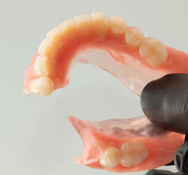 Broken Dentures