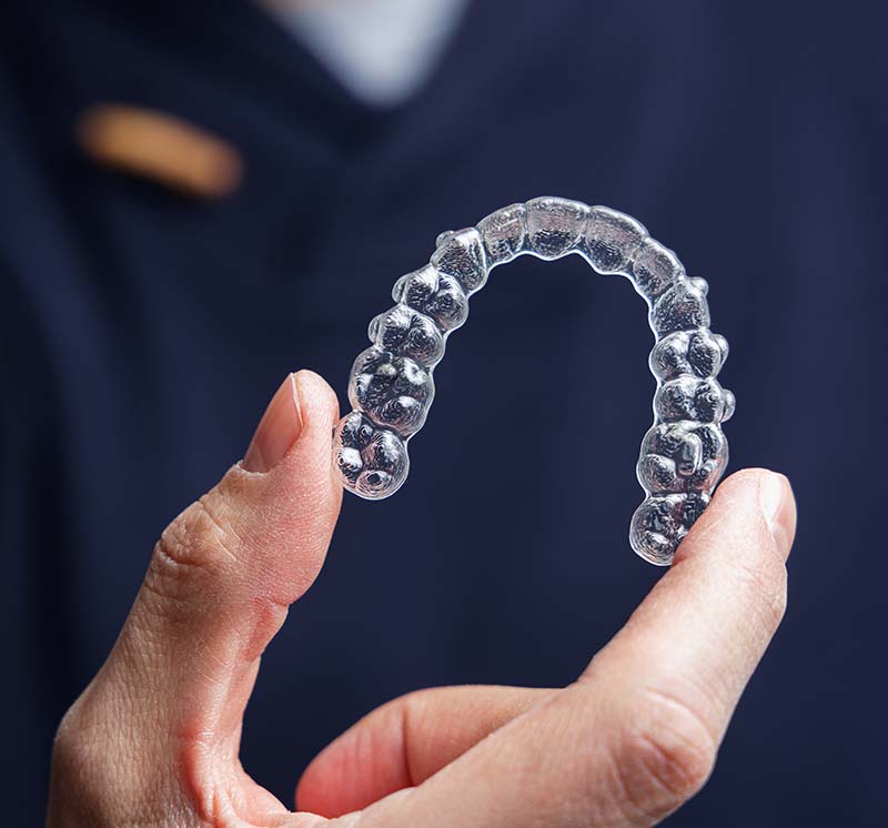 Clear Aligners