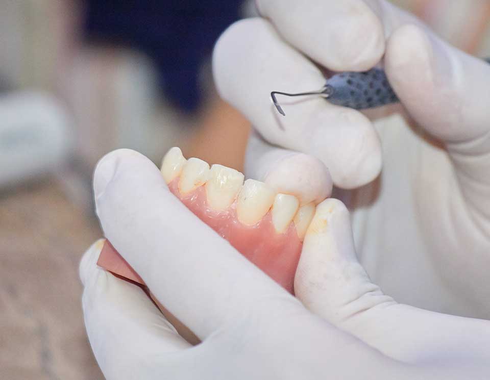 Dental Repair