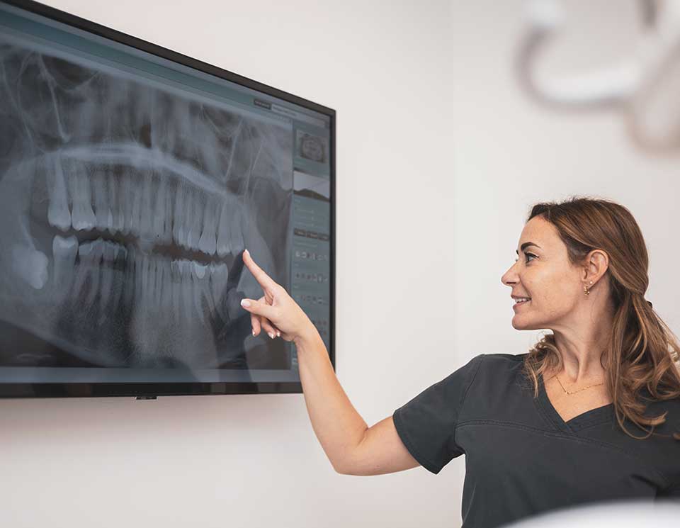 Digital X-Rays