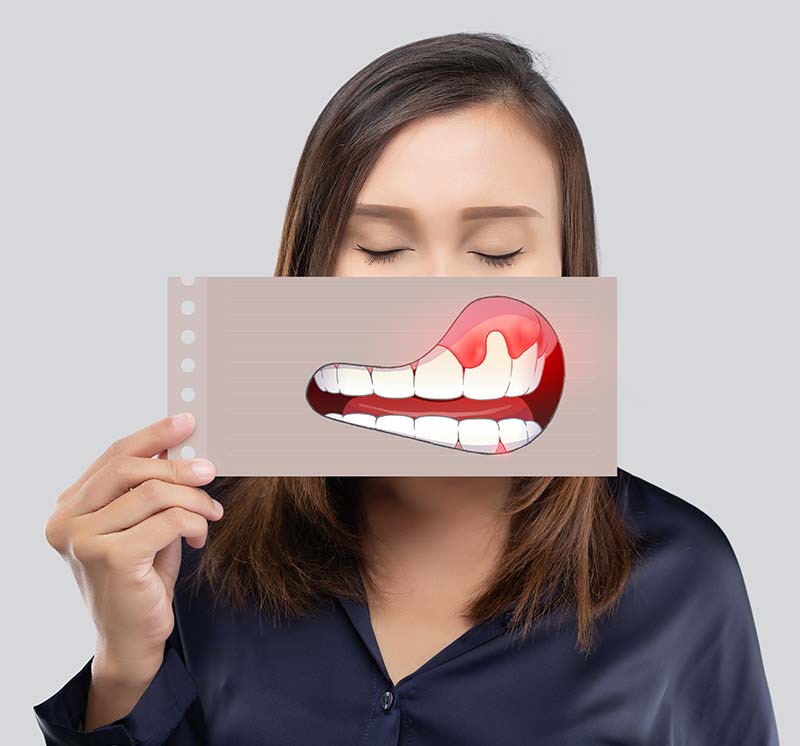 Periodontal