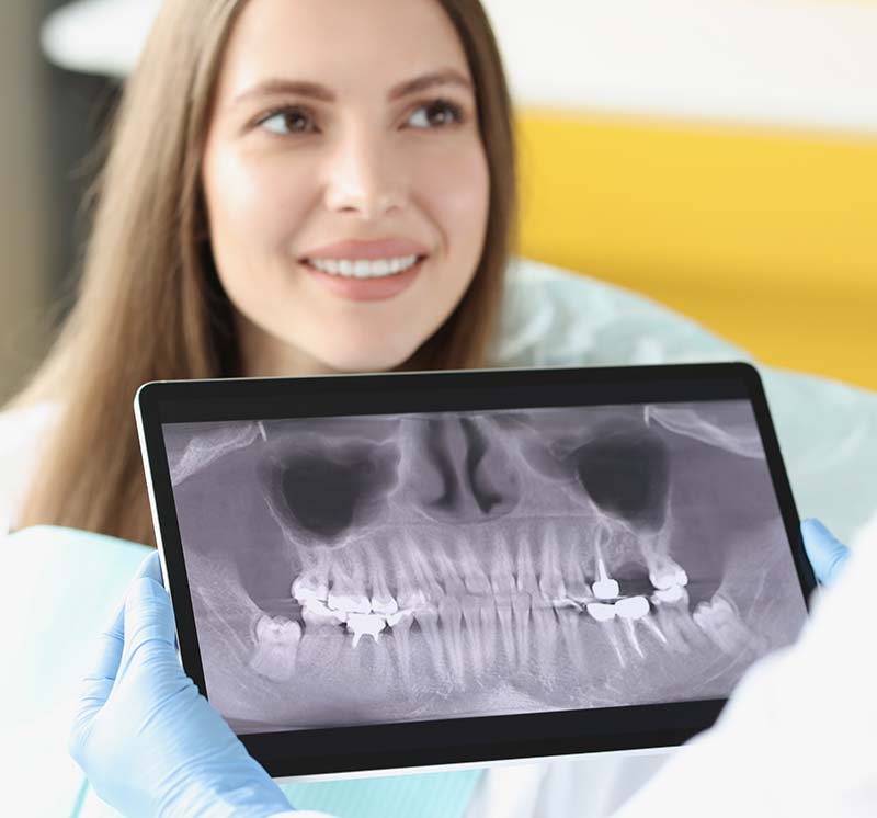 Stress Free X-rays