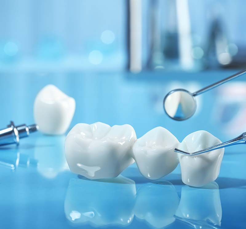 Types of Dental Crowns